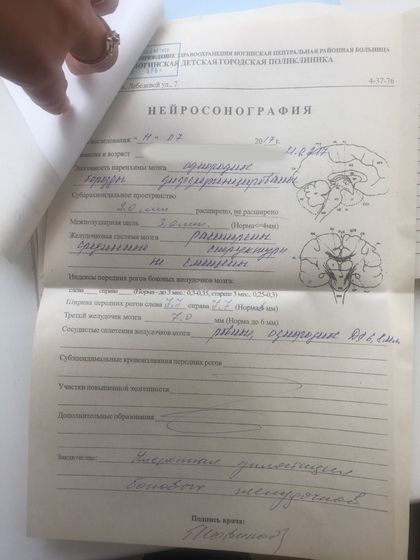 Умеренная дилатация боковых желудочков головного мозга.