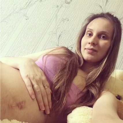 Пессарий прочь