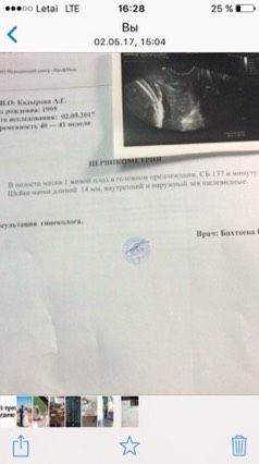 Шейка в 40 недель