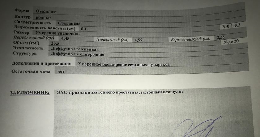 УЗИ Предстательной железы