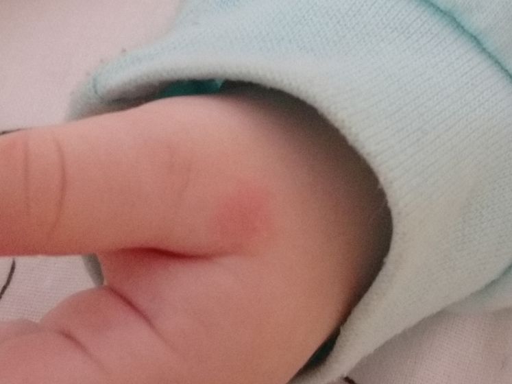 Комары в октябре???