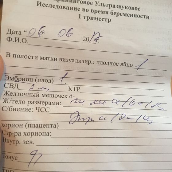 Сходила На УЗИ