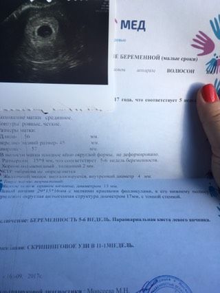 Первое УЗИ