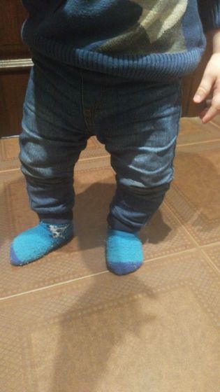 Кривые ножки
