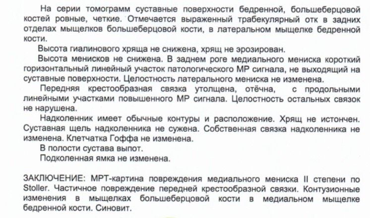 Вывих колена, результаты МРТ