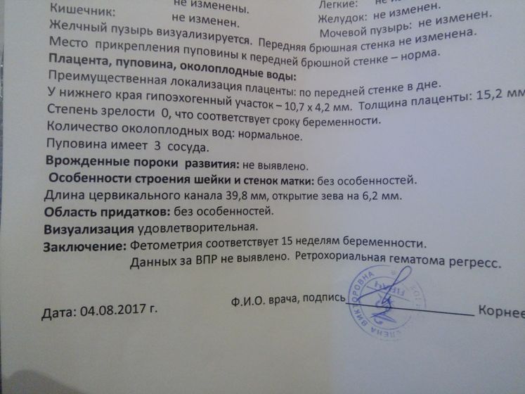 Сходила на Узи, сказали
