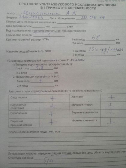 Про узи в Гродно