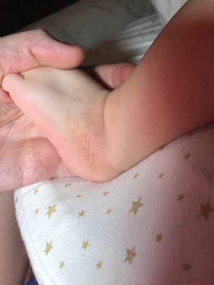 Девочки, подскажите? у малыша