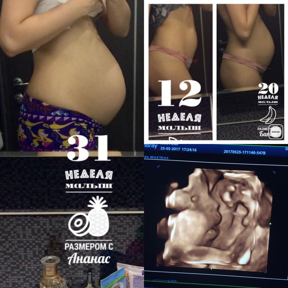 30 недель??