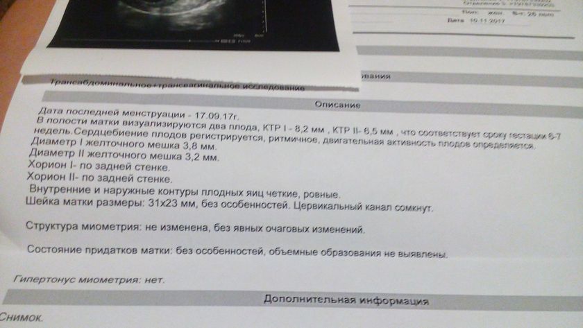 Ди ди двойня.