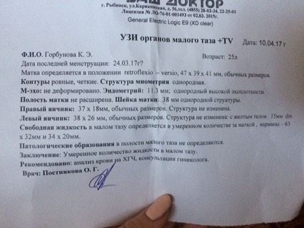 Узи