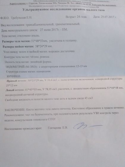 Копец девочки😭
