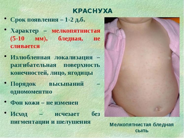 Краснуха