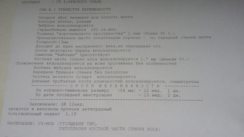 Гипоплазия костной части спинки носа (1 скрининг)