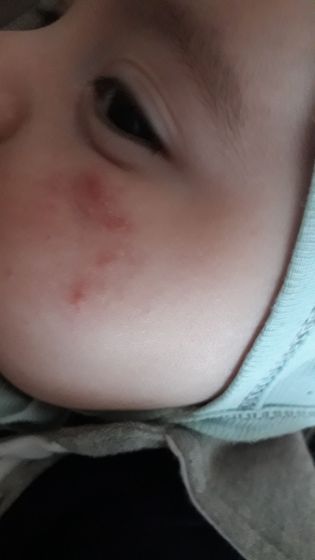 А-DERMA