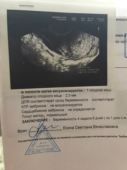 Сделала УЗИ и ужаснулась! ?