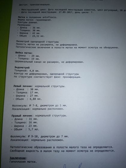 Узи
