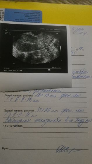 Узи