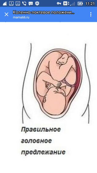 Коленно-локтевая поза) как правильно принимать его!Кому интересно, а то я очень долго искала эту инфу для себя))Может ещё кому-…