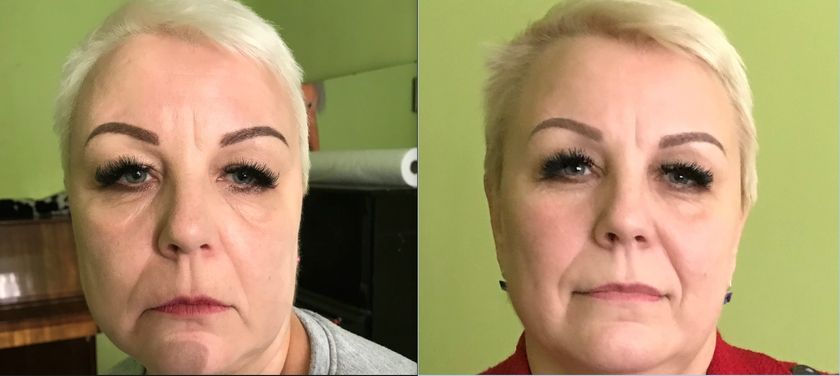 Эстетическое моделирования лица и тела