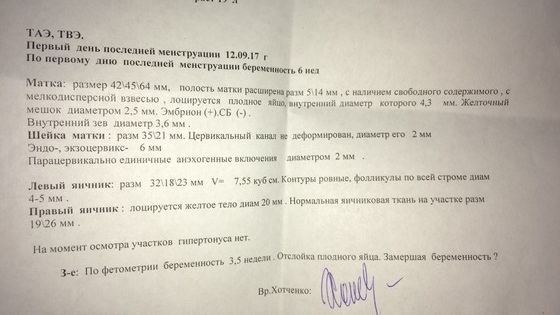 Я в заблуждении...!!!