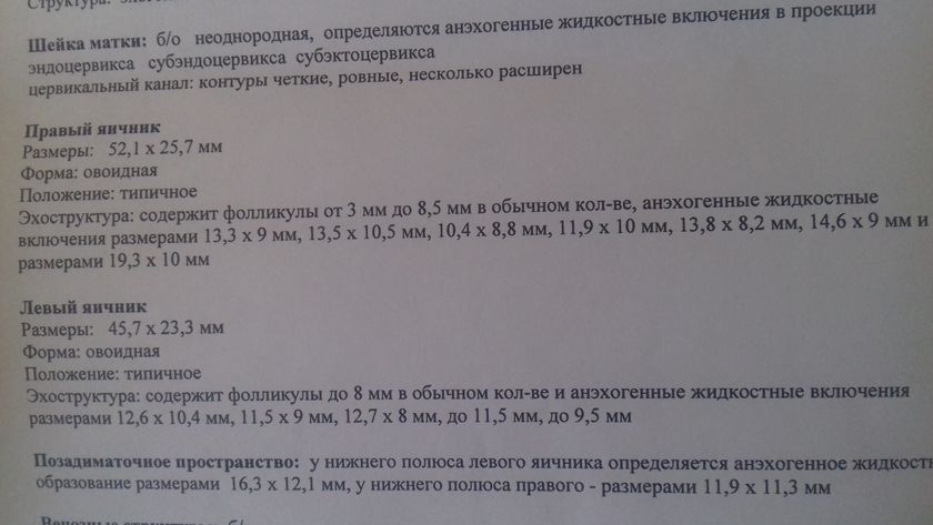 УЗИ 26 ДЦ. Спойлер : я жива ?