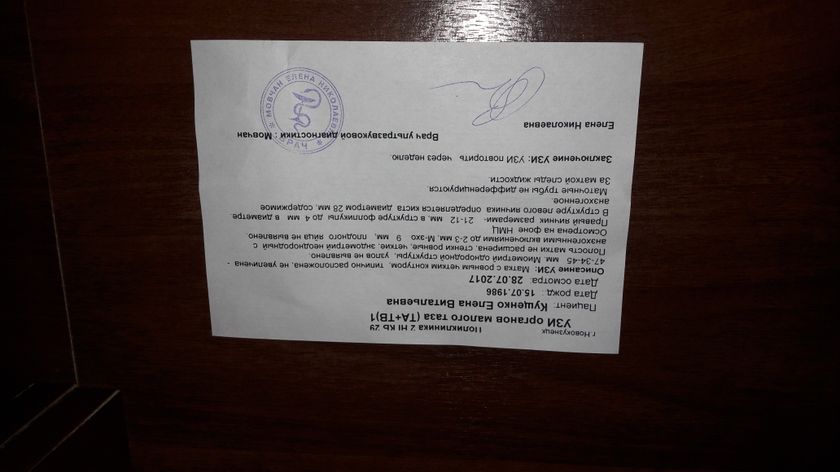 Кто понимает узи.