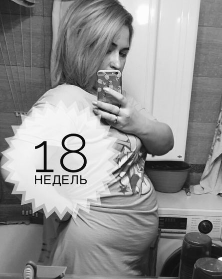 18 недель с тремя пупсиками✨