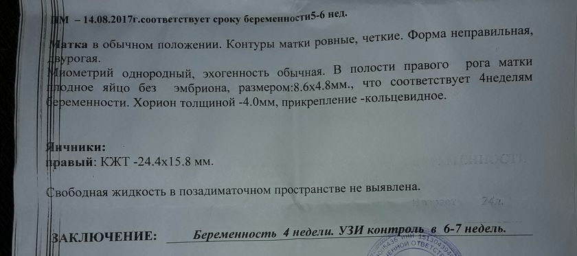 Девочки сегодня узи зделала