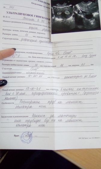 Анэхогенное включение-что это? У кого было?