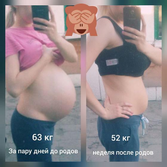 Фигура после родов??