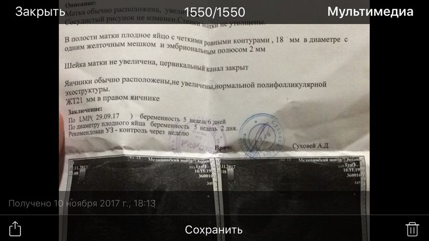 Девочки вот УЗИ и
