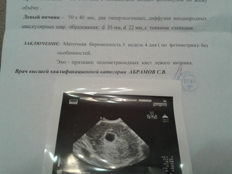 Итак...