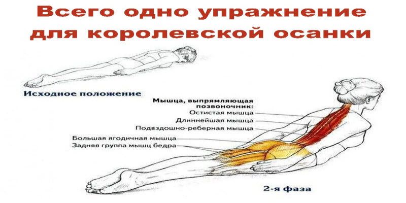 Осанка