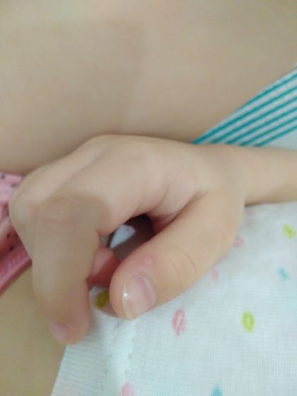 Как начинают проявляться бородавки, или что это может быть??