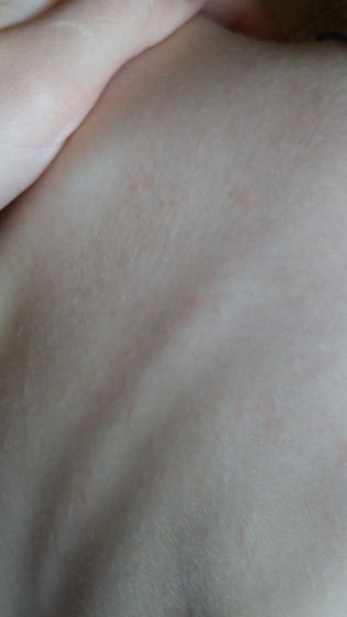 Скажите что это может быть к врачу только завтра.