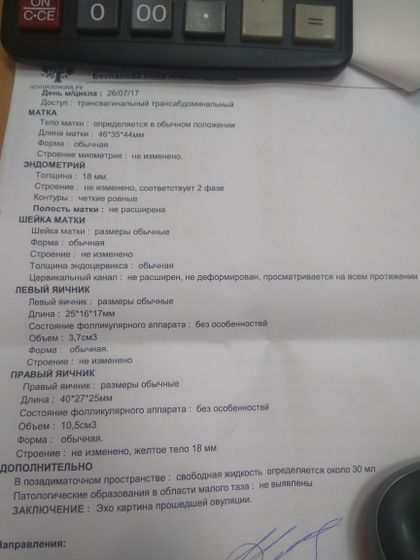 узи на 28 день цикла