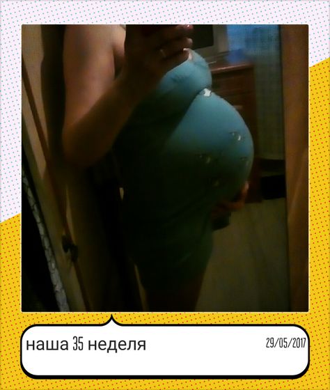 Сегодня наша 35 неделька,почти