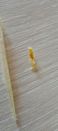 ????