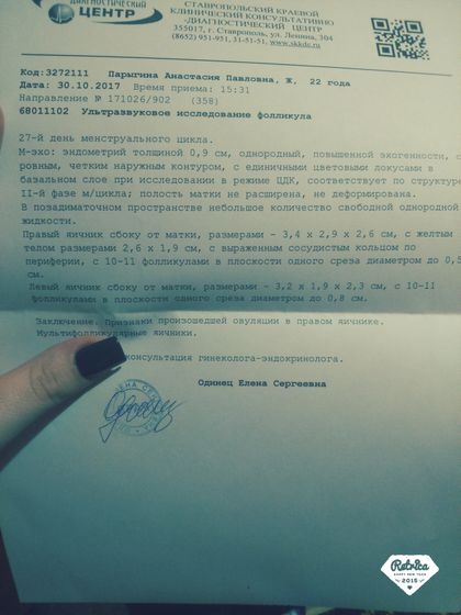 Сходила на узи, в