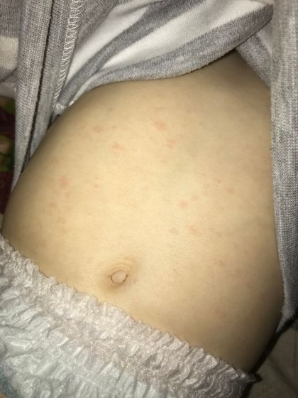 Красные пятна