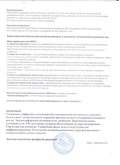 Помогите расшифровать ЭЭГ!