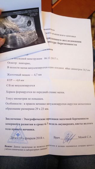 ЗБ.Полная история. Может,кому сгодится.