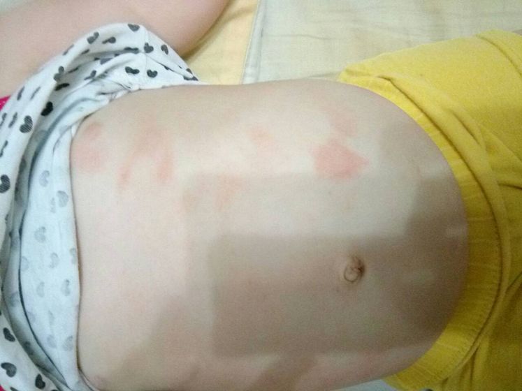 что такое может быть?