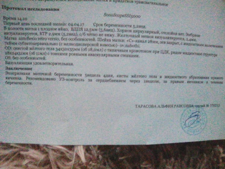 Коричневая мазня