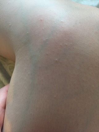 Что это может быть? Как лечить?