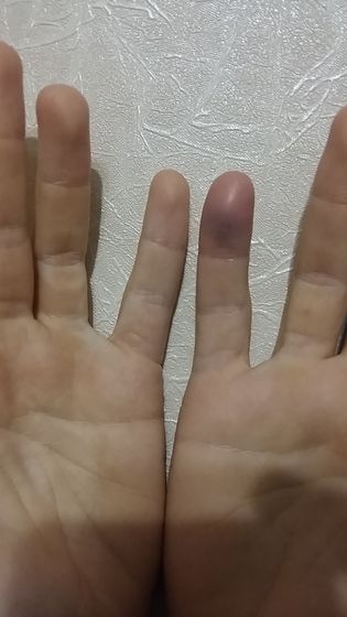 Ехать в больницу или до утра?