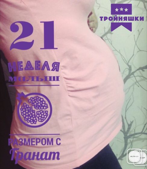 21 неделя. Тройня.