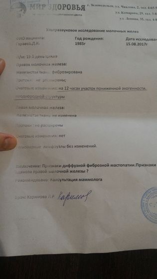 Диффузно фиброзная мастопатия. Признак аденоза?
