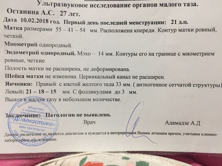 Овуляция по узи